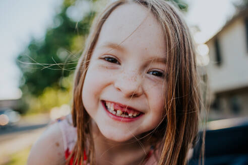 Close up of happy little girl missing a front tooth - CAVF88077