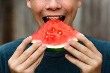 Jugendlicher mit Zahnspange beißt in Wassermelone - CAVF88112