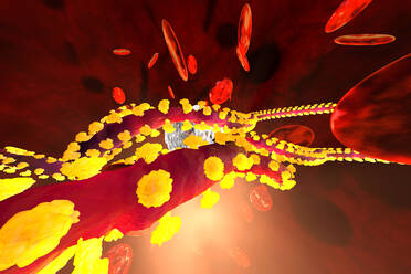 Dreidimensionale Darstellung des Ebola-Virus im Kampf mit weißen Blutkörperchen im Blutkreislauf - SPCF00875