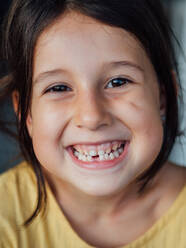 Glückliches Kind ohne Zahn, das in die Kamera schaut und fröhlich lächelt - ADSF14649