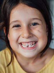 Happy child without tooth looking at camera and cheerfully smiling - ADSF14649