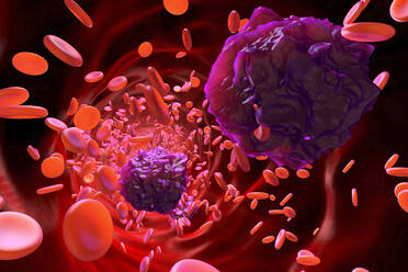 3D rendered Illustration of Leukemia cells in the blood stream - SPCF01014