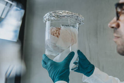 Scientist hand holding preserved human brain beaker while standing at clinic corridor stock photo