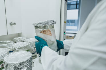 Scientist holding preserved human brain beaker while standing at laboratory - MFF06523