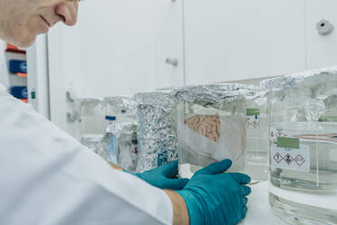 Man arranging human brain beaker while standing at laboratory - MFF06525