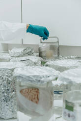 Scientist working by preserved human brain beaker at laboratory - MFF06527