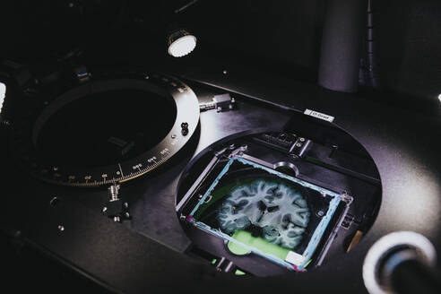 Präparat eines menschlichen Gehirns im Vorausmikroskop im Labor - MFF06612