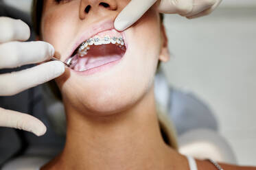 From above crop unrecognizable female dentist in gloves using mirror to check teeth of woman with braces during work in contemporary clinic - ADSF17275