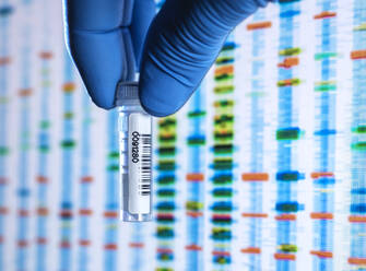 Scientists hand in latex glove holding vial containing sample with DNA results on screen in background - ABRF00783