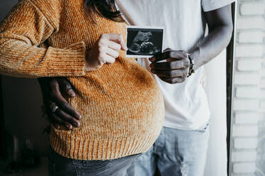 Schwangere Frau mit jungem Mann zeigt Ultraschalluntersuchung zu Hause - EBBF01637