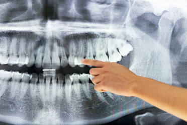 Abgeschnittene, nicht erkennbare Zahnärztin in Uniform und medizinischer Maske, die eine Röntgenaufnahme von Kiefer und Zähnen untersucht - ADSF18026