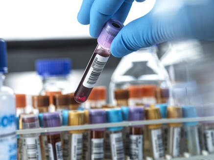 Männlicher Wissenschaftler hält Blutprobenfläschchen im Labor - ABRF00789