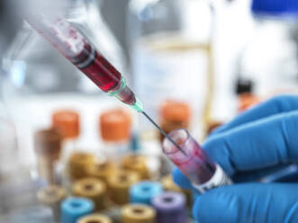 Biomedical scientist working with blood sample at laboratory - ABRF00790