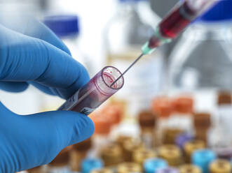 Biomedizintechniker, der eine Blutprobe im Labor untersucht - ABRF00792