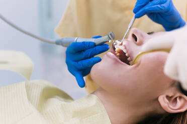 Junge Patientin mit offenem Mund bei der zahnärztlichen Inspektion - ADSF18917