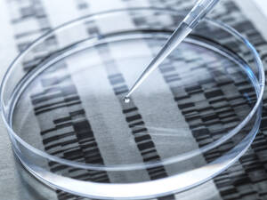 Experiment mit einer DNA-Probe in einer Petrischale mit DNA-Ergebnissen im Hintergrund - ABRF00811