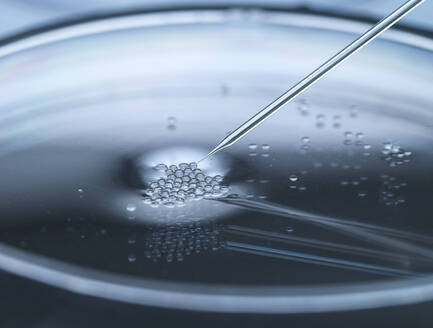 Kerntransfer bei embryonalen Stammzellen, die zum Klonen und zur genetischen Veränderung verwendet werden - ABRF00815