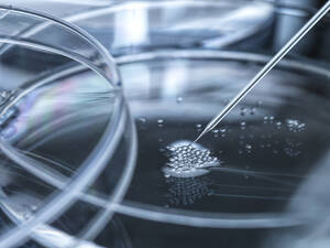 Petrischale mit embryonalen Stammzellen, die zum Klonen und zur genetischen Veränderung verwendet werden - ABRF00816