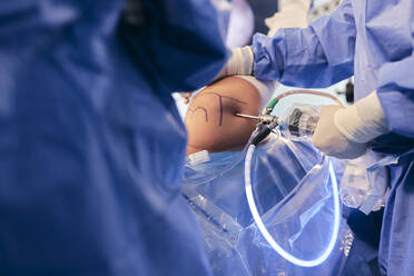 Doctors inserting endoscopy equipment while operating at operation room - SASF00144