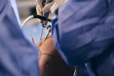 Arzt beim Einsetzen der endoskopischen Ausrüstung während einer Operation im Operationssaal - SASF00147