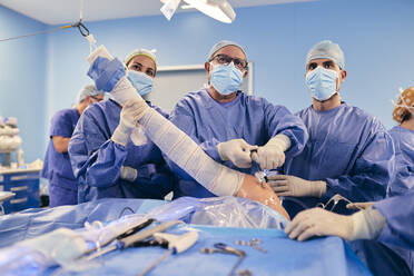 Ein Ärzteteam mit Endoskopausrüstung bei einer arthroskopischen Schulteroperation im Operationssaal während der COVID-19 - SASF00164