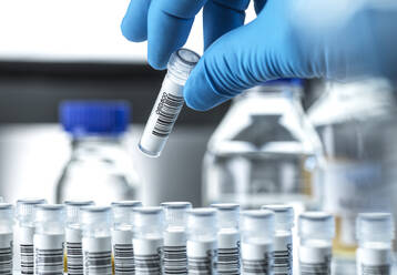 Klinische Tests, DNA-Probe wird für den Test im Labor vorbereitet. - CAVF91895