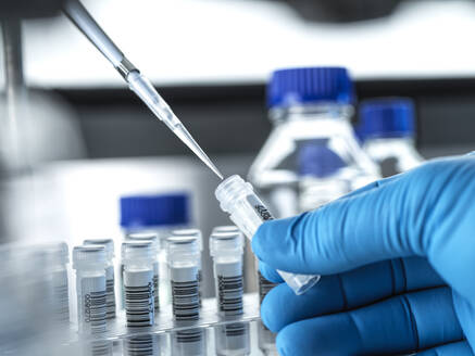 Klinische Tests, DNA-Probe wird für den Test im Labor vorbereitet. - CAVF91896