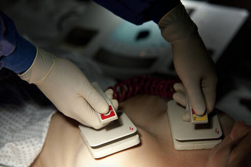 Hände eines Arztes, der einen Defibrillator auf der Brust eines Patienten im Krankenhaus hält - UKOF00113