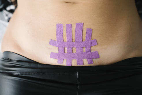Violettes elastisches therapeutisches Band auf dem Bauch einer Frau - MPPF01494