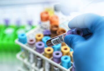 Medical technician preparing human samples for medical testing in lab - CAVF93174