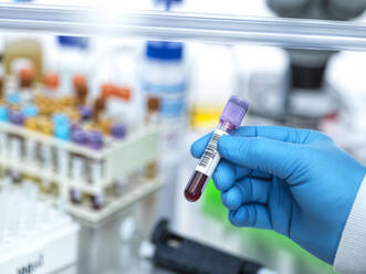 Medical technician preparing human samples for medical testing in lab - CAVF93175