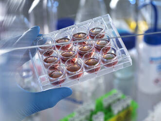Wissenschaftler, der eine Multiwellplatte mit Blutproben im Labor hält - ABRF00835
