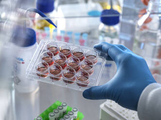 Wissenschaftlerin hält Multiwellplatte mit Blutproben im Abzug - ABRF00837
