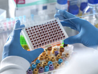 Männlicher Wissenschaftler hält Blutproben in einer Multiwellplatte im Labor - ABRF00846