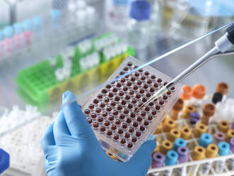Wissenschaftler, der eine Blutprobe in eine Mikroplatte im Labor pipettiert - ABRF00848