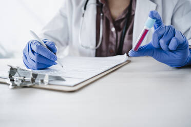 Female doctor holding blood sample while writing medical report at desk - EBBF02673