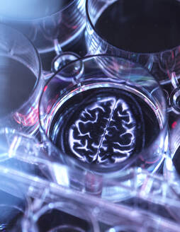 Medical sample inside microplate with image of human brain - ABRF00876