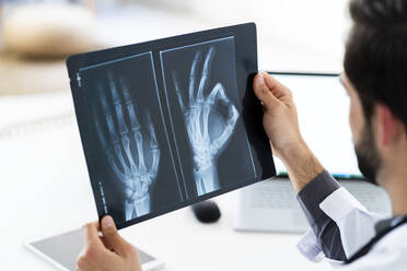 Männlicher Arzt, der ein medizinisches Röntgenbild untersucht - GIOF12229