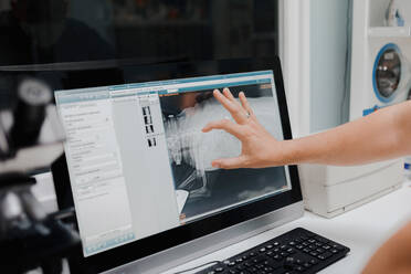 Anonymer Tierarzt zeigt Röntgenbild auf Computerbildschirm bei der Arbeit im Labor - ADSF22623