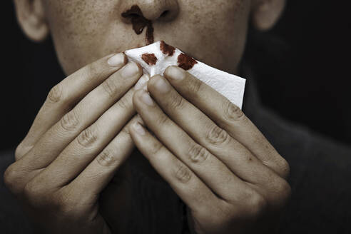 Mittlere erwachsene Frau hält Taschentuchpapier, während die Nase blutet - AZF00336