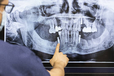 Männlicher Zahnarzt bei der Untersuchung von Röntgenbildern in einer Klinik - PNAF01931
