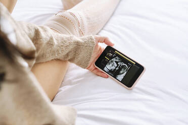 Woman with ultrasound picture on smartphone at home - AODF00507