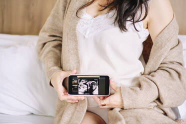 Pregnant woman showing ultrasound image on smart phone at home - AODF00509