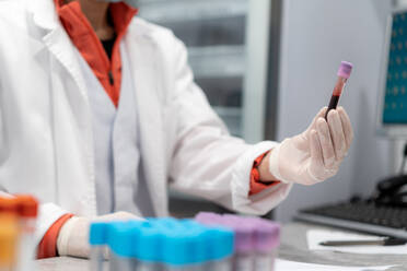 Unbekannte Ärztin mit Maske und Handschuhen hält ein Röhrchen mit einer Blutprobe in einem modernen Labor in einer Klinik - ADSF25270