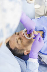 Hoher Winkel der Ernte Kieferorthopäde in Handschuhen Installation von Zahn-Veneers auf die Zähne zum Schutz während der Sitzung in der Klinik - ADSF27110