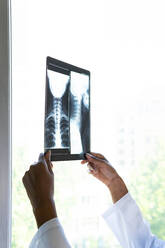 Crop schwarzen weiblichen Arzt stehend in der Nähe von Fenster und Prüfung X-ray-Scan bei der Arbeit in der Klinik - ADSF27952