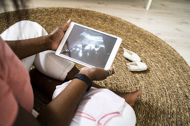 Schwangere Frau hält digitales Tablet mit Ultraschallvideo zu Hause - GIOF13143