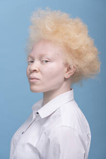 Studio portrait of albino woman in white shirt - ISF24904