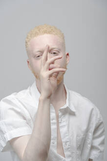 Studio-Porträt eines Albino-Mannes im weißen Hemd - ISF24920