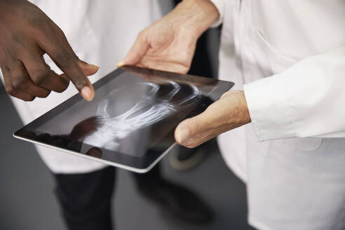 Arzt mit Kollege hält Tablet-PC mit Röntgenbild im Krankenhaus - PMF02145